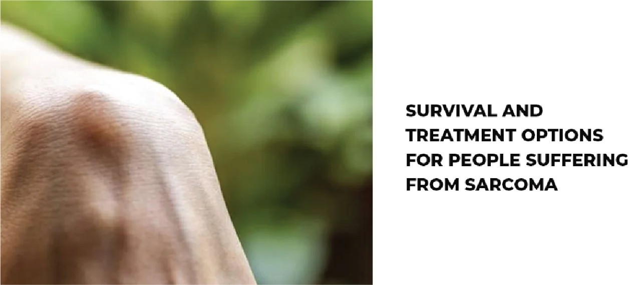 Survival and treatment options for people suffering from Sarcoma